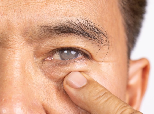 Cirurgia de Catarata e Diabetes: Quais Cuidados Você Deve Ter?